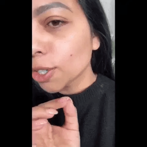 Smart Acne Patches With Light Therapy (6 Patches)