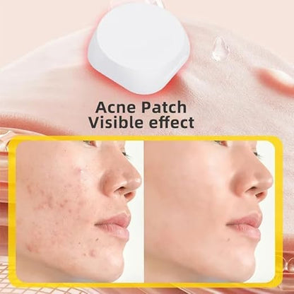 Smart Acne Patches With Light Therapy (6 Patches)